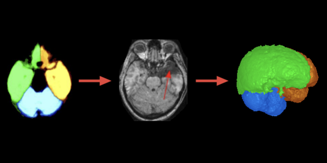 Medium medical segmentation